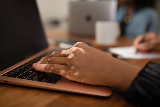 Individual with vitiligo submitting forms to the WV e-Directive Registry